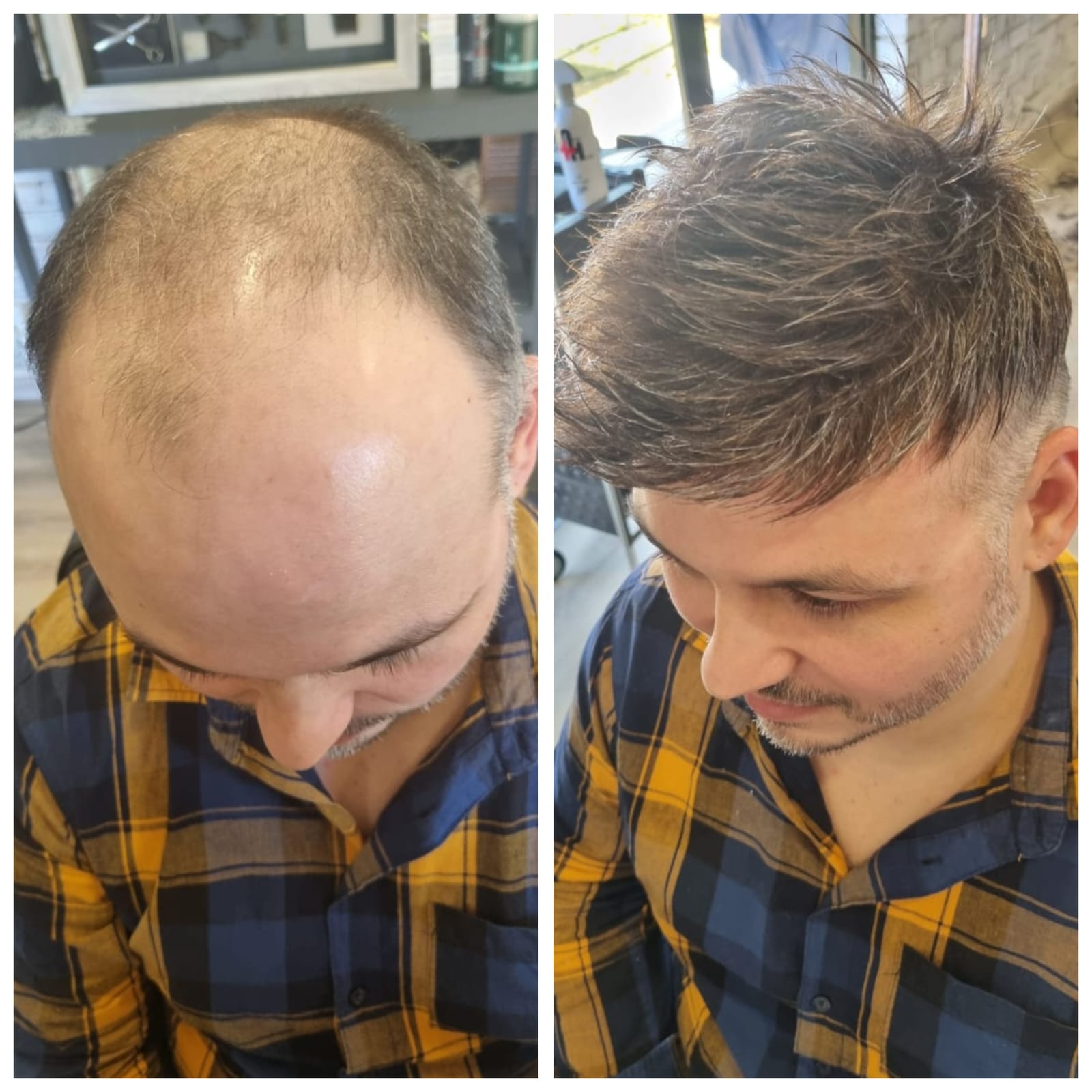 Before & After 2